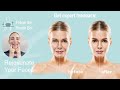 Reshape Mouth and Cheeks With Face Yoga  | How to do Face Yoga Exercise |Yummy Face | Forever Beauty