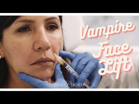 Video: Vampire Facelift: Protseduur, Kulud, Ohutus Ja Palju Muud