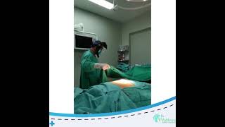 MANGA GASTRICA EN LIMA PERU 👀 👨‍⚕ DR VALDIVIA