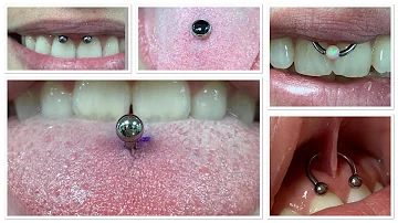 ¿Los piercings labiales dañan los dientes?