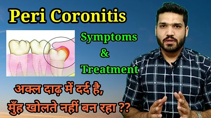 Peri Coronitis , Symptoms & Treatment |       !