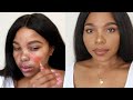 HOW TO  COVER  HYPERPIGMENTATION AND DARK SPOTS ON BROWN SKIN