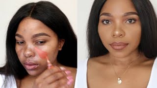 HOW TO  COVER  HYPERPIGMENTATION AND DARK SPOTS ON BROWN SKIN