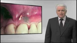 Endodontic Diagnosis with Dr. Cliff Ruddle