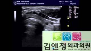 김앤정외과의원 갑상선 조직검사세침흡인세포검사
