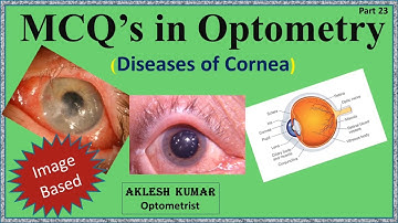 Diseases of Cornea | MCQ