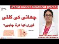 Breast Cancer Surgery Treatment Urdu Hindi Chati Ke Gilti Ka Ilaj Prof Dr Amna Javed Healthtal Breast Cancer Surgery Treatment Urdu Hindi Chati Ke Gilti Ka Ilaj Prof Dr Amna Javed Healthtal