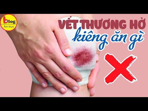 Top 8 thực phẩm nên kiêng ăn khi có vết thương hở