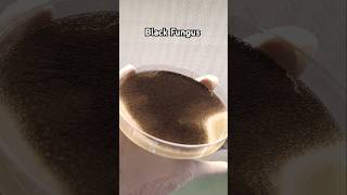 Black Fungus On Sda Wchloramphenicol