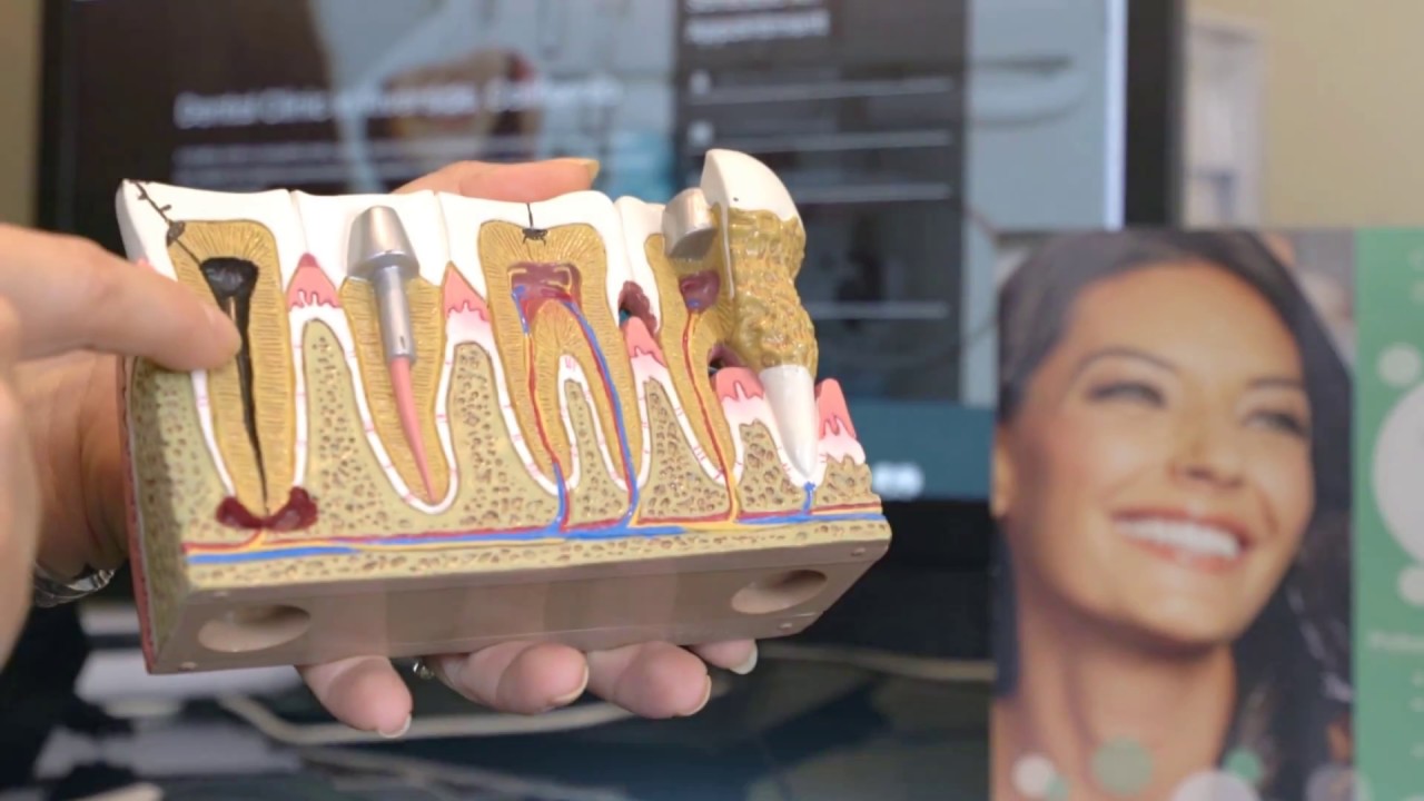 Dentist In Riverside County CA YouTube