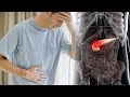 Early Signs and Symptoms of Pancreatic Cancer!