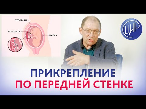 Видео: Всегда ли у меня будет передняя плацента?