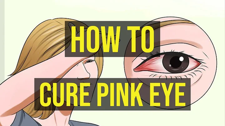 How To Cure Pink Eye Fast | 5 Quick Ways - DayDayNews