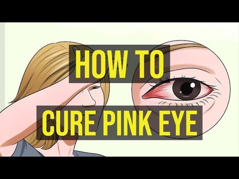 Vídeo: Cómo Deshacerse De Pink Eye Fast, Además De Lo Que No Debe Hacer