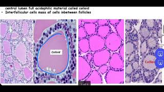 Histo lab  (thyroid and parathyroid gland)