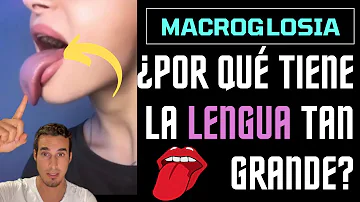 ¿Puedes reducir el tamaño de tu lengua?