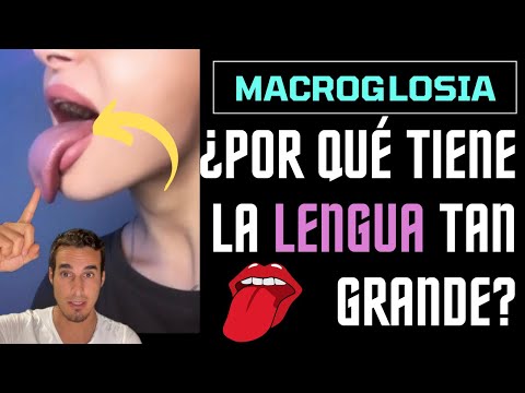 Video: ¿Por qué tengo la lengua larga?