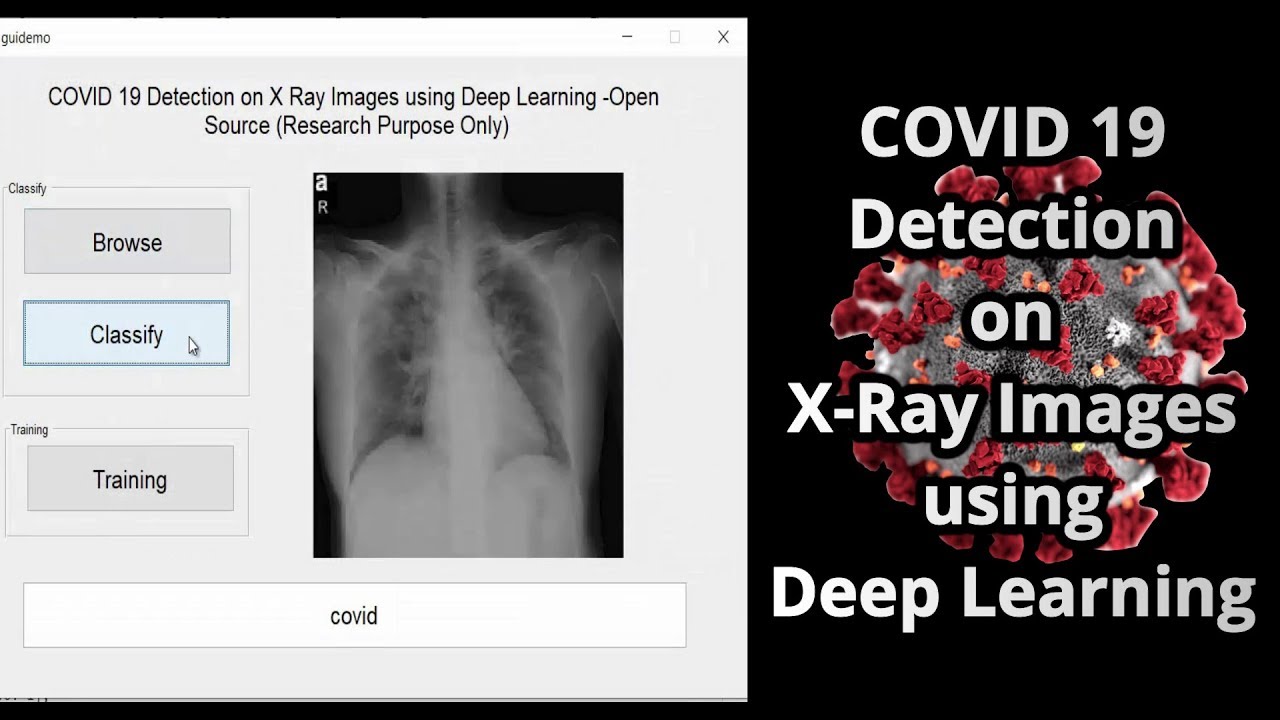 COVID 19 Detection on X Ray Images using Deep Learning - YouTube