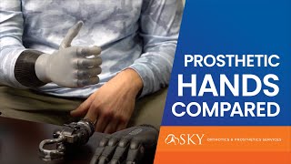 Prosthetic Hands Compared