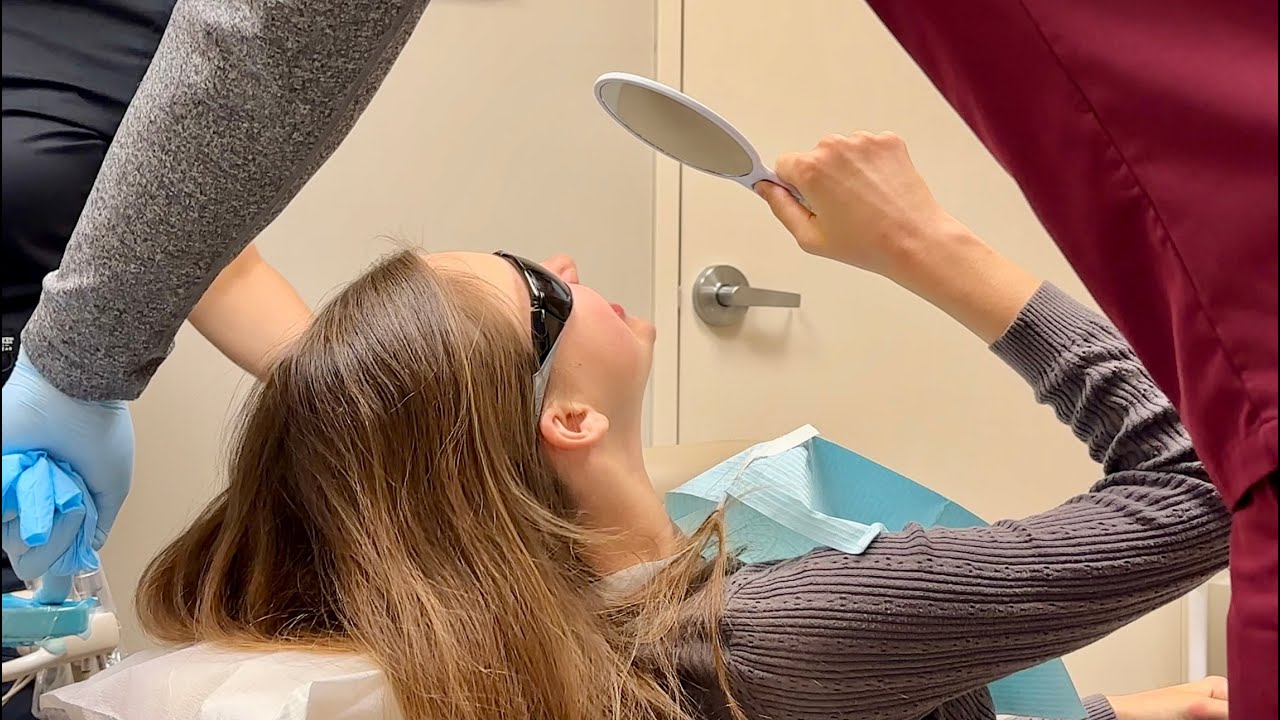 From the crooked teeth to a beautiful smile - Before and After Results