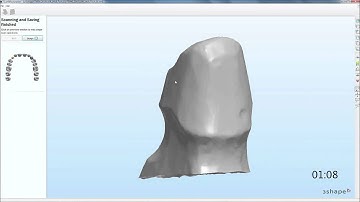 Dental System™ 2010 - Coping in less than 2 min