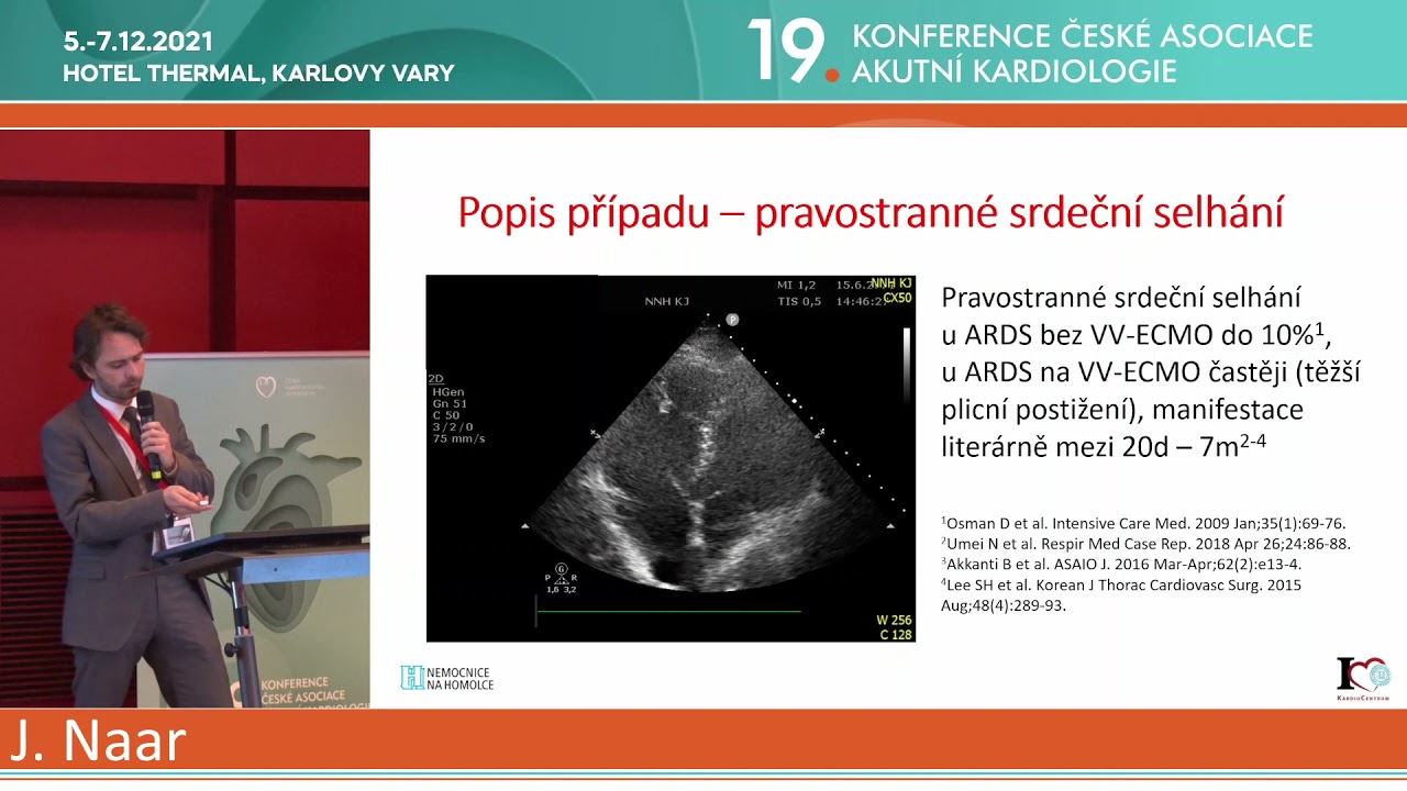 video: 207 DN NA VV ECMO - A DO TRANSPLANTACE PLIC