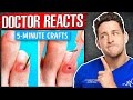 The WORST 5-Minute Crafts “Health Hacks” image