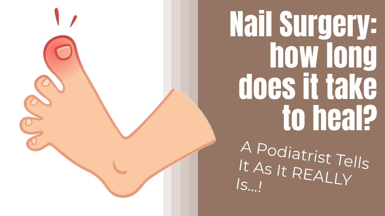 How long is nail surgery recovery?