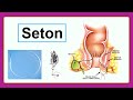 seton