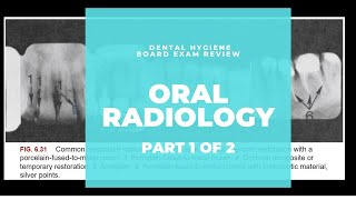 NBDHE  DENTAL HYGIENE BOARD EXAM REVIEW: Everything you need to know about Radiography(Part 1 of 2)