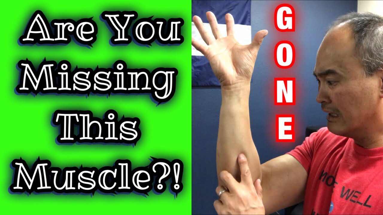 How Do You Know If You Have A Palmaris Longus?