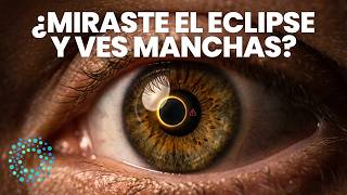 Watch Out! 3 Signs the ECLIPSE Damaged Your RETINA (Quick Vision Tests) 👁️⚠️