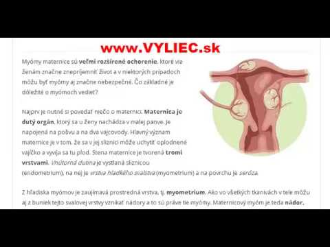Video: Myómy Maternice - Príznaky, Príčiny A Liečba