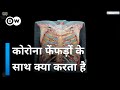 कोरोना कैसे फेफड़े पर वार करता है, देखिए [How Cororna affects our lungs]