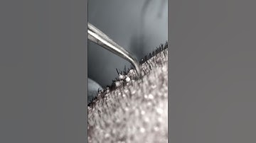 Hair Transplant Procedure at Care4Hair