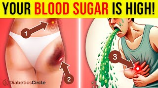 10 SURPRISING Causes of Diabetes You Need To Know