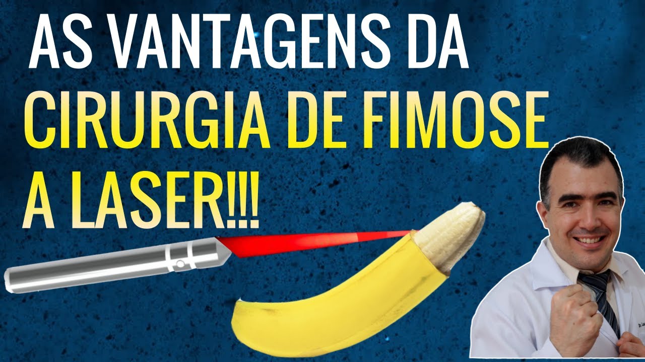 Cirurgia De Fimose Quanto Tempo Dura CIRURGIA DE FIMOSE A LASER: quais são as principais vantagens? - YouTube
