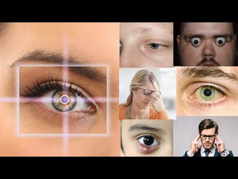 Video: Հիվանդություններ, որոնք «տեսանելի են աչքերում»