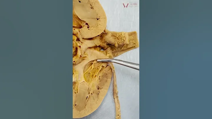 How a REAL Kidney Makes Urine - DayDayNews