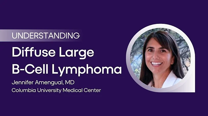 Understanding Diffuse Large B-Cell Lymphoma with J...