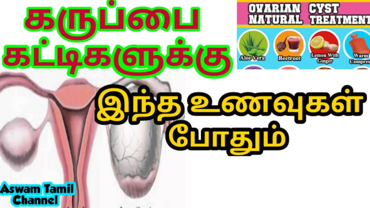 கருப்பை கட்டிகளை குணமாக்கும் சிறந்த உணவுகள் Foods for fibroid uterus tamilகருப்பை கட்டிகள்