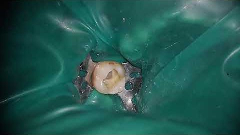 xp shaper ledge bypass