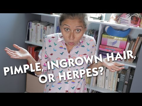 Video: Ingrown Hair Or Herpes: How To Tell The Difference