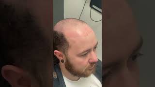 Is It a Wig? Is It a Toupee? No!! It's a Hair System! #Shorts Is It a Wig? Is It a Toupee? No!! It's a Hair System! #Shorts