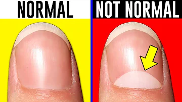 10 Signs You're Actually Normal..