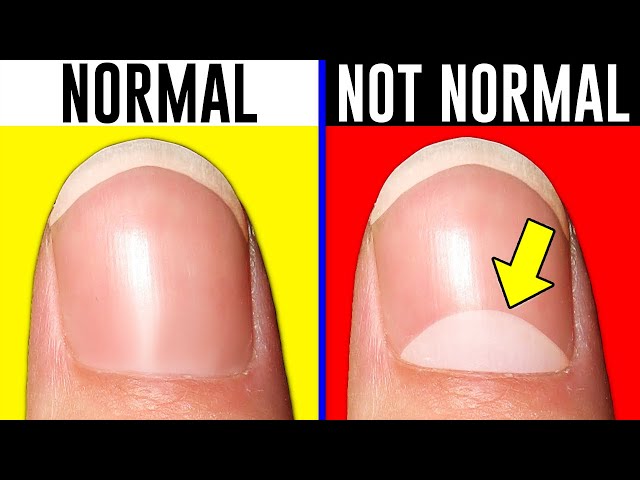 10 Signs Youre Actually Normal..