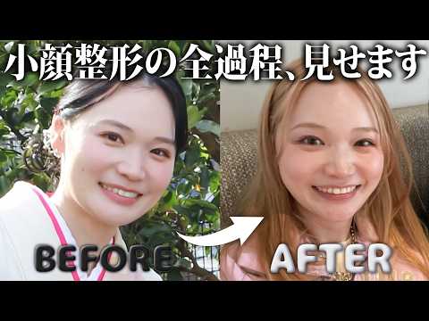 [A CLINIC x Moechobin] Real reviews of beauty treatments you'll want to try.