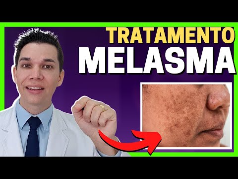 Como TRATAR MELASMA