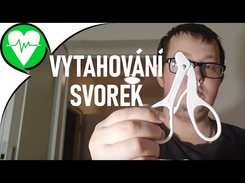 Video: Chirurgické Svorky: Ako Sa Umiestňujú, Odstraňujú A Pomáhajú Liečiť