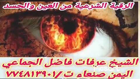 أفضل رقية شرعية علآج العين والحسد الشيخ عرفات بن  فاضل الجماعي راقي شرعي في اليمن صنعاء _ ٧٧٤٨١٣٩٠١